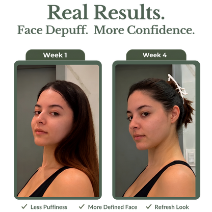 FLEXORS™ Lymphatic Drainage Drops